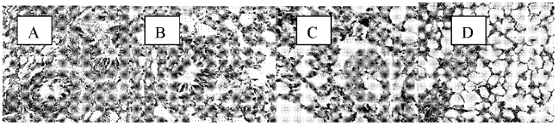 Medicinal composition capable of expanding tracheal smooth muscles and application thereof