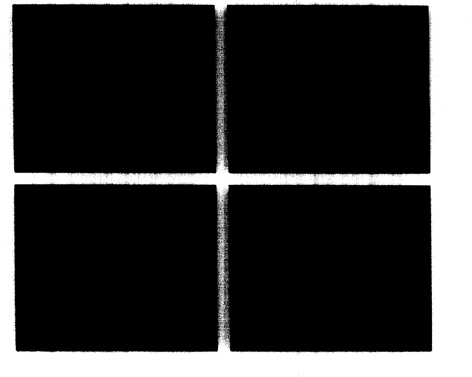 Application of musculus growth inhibin for preparing anticarcinogen