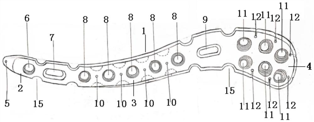 Far-end clavicle bone fracture plate