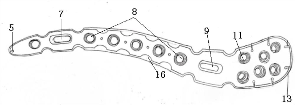 Far-end clavicle bone fracture plate