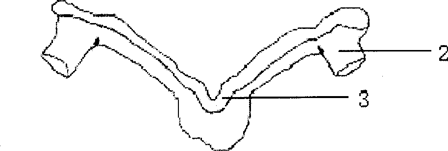 Production method of navigation template for positioning the pediculus arcus vertebrae