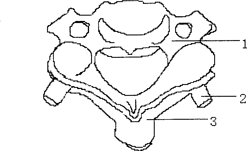 Production method of navigation template for positioning the pediculus arcus vertebrae