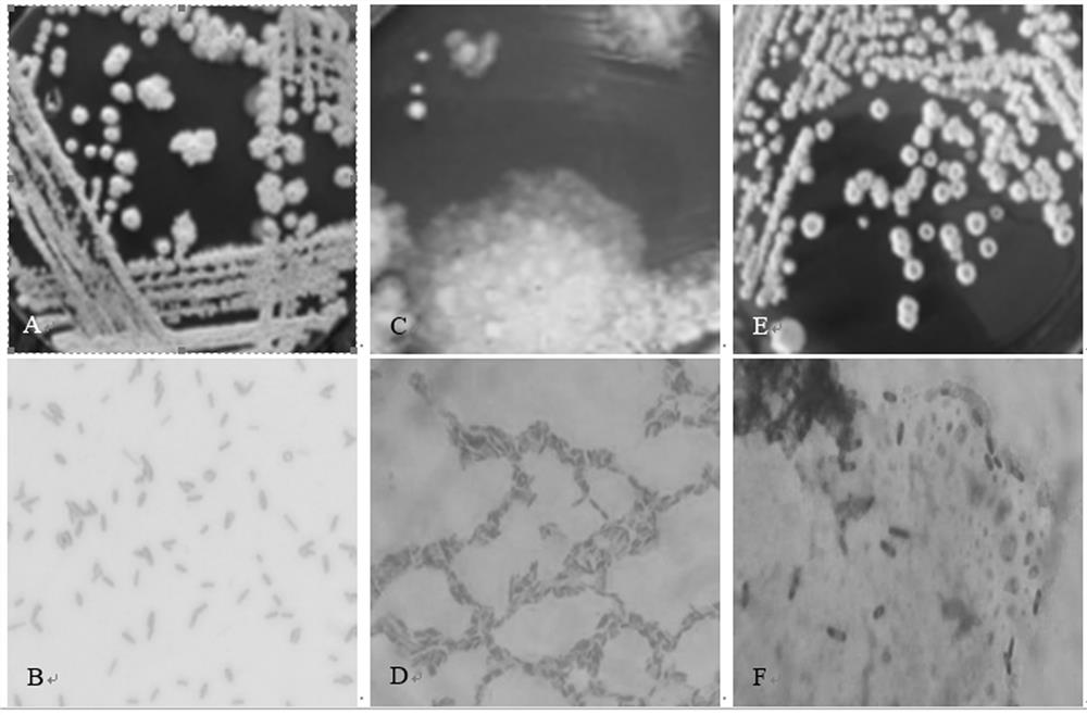 A fresh-cut fruit and vegetable preservative compounded by the bacteriostatic substances produced by Bacillus licheniformis, Bacillus atrophicus and Bacillus amyloliquefaciens