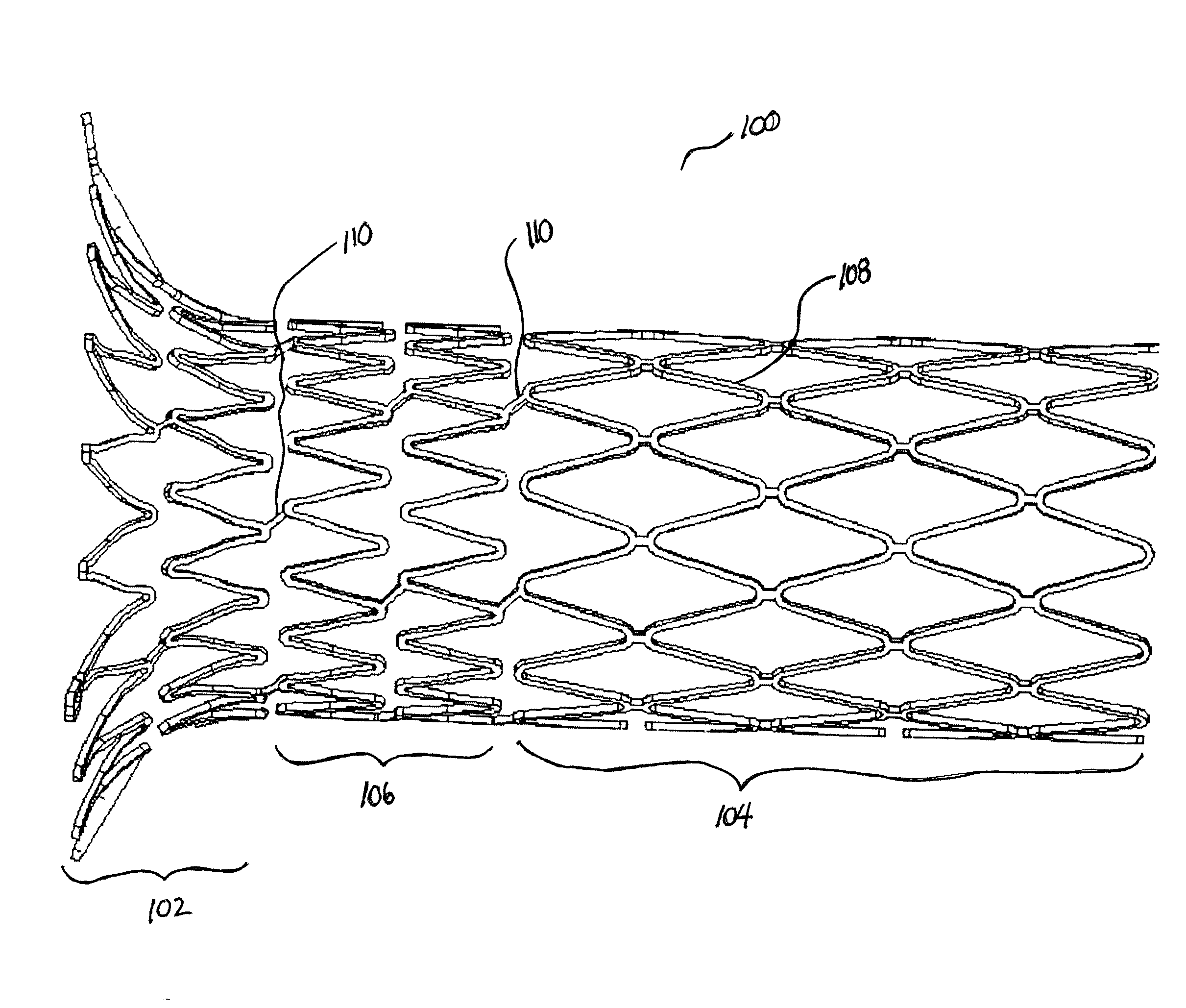 Sheath With Radio-Opaque Markers For Identifying Split Propagation