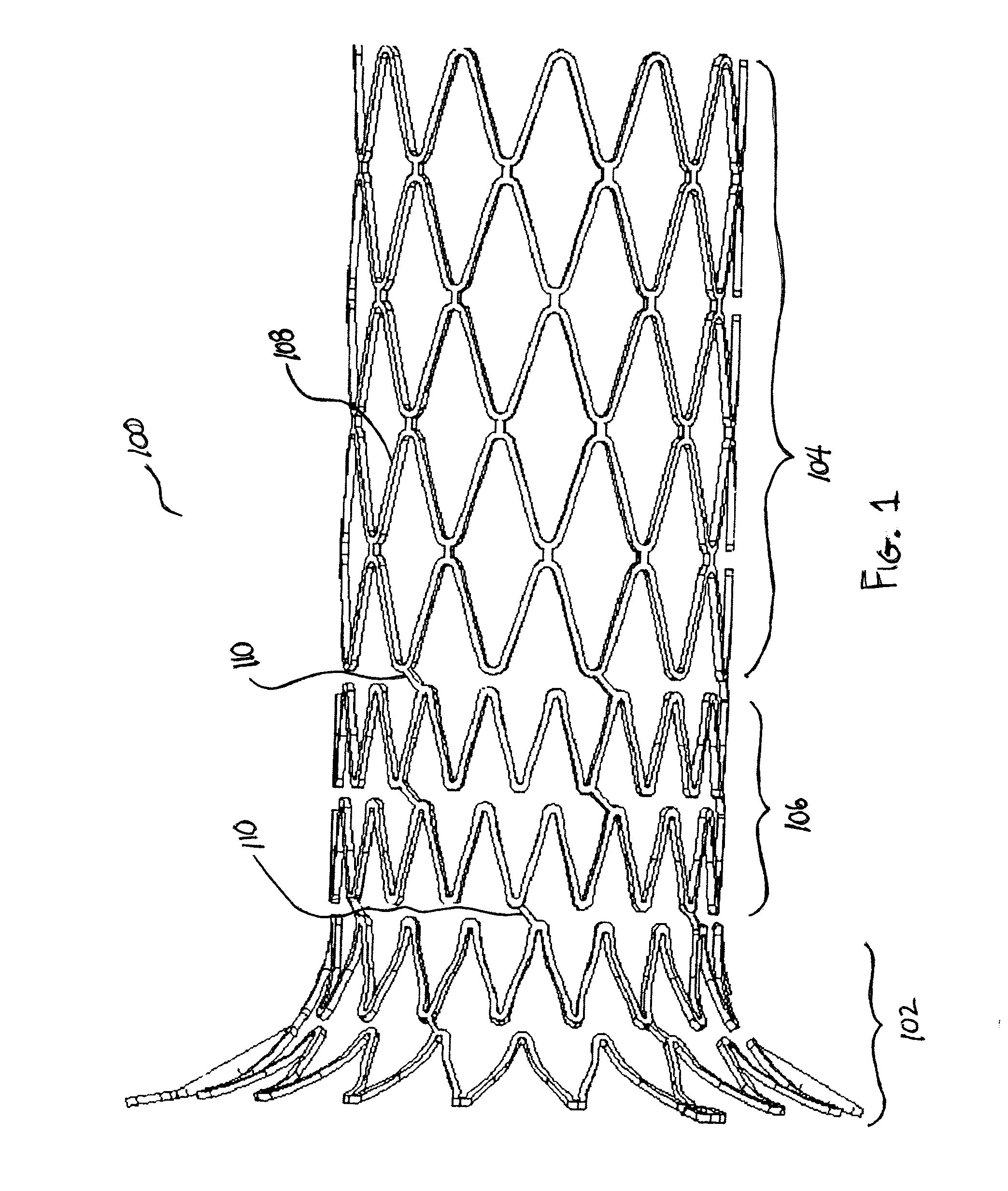 Sheath With Radio-Opaque Markers For Identifying Split Propagation