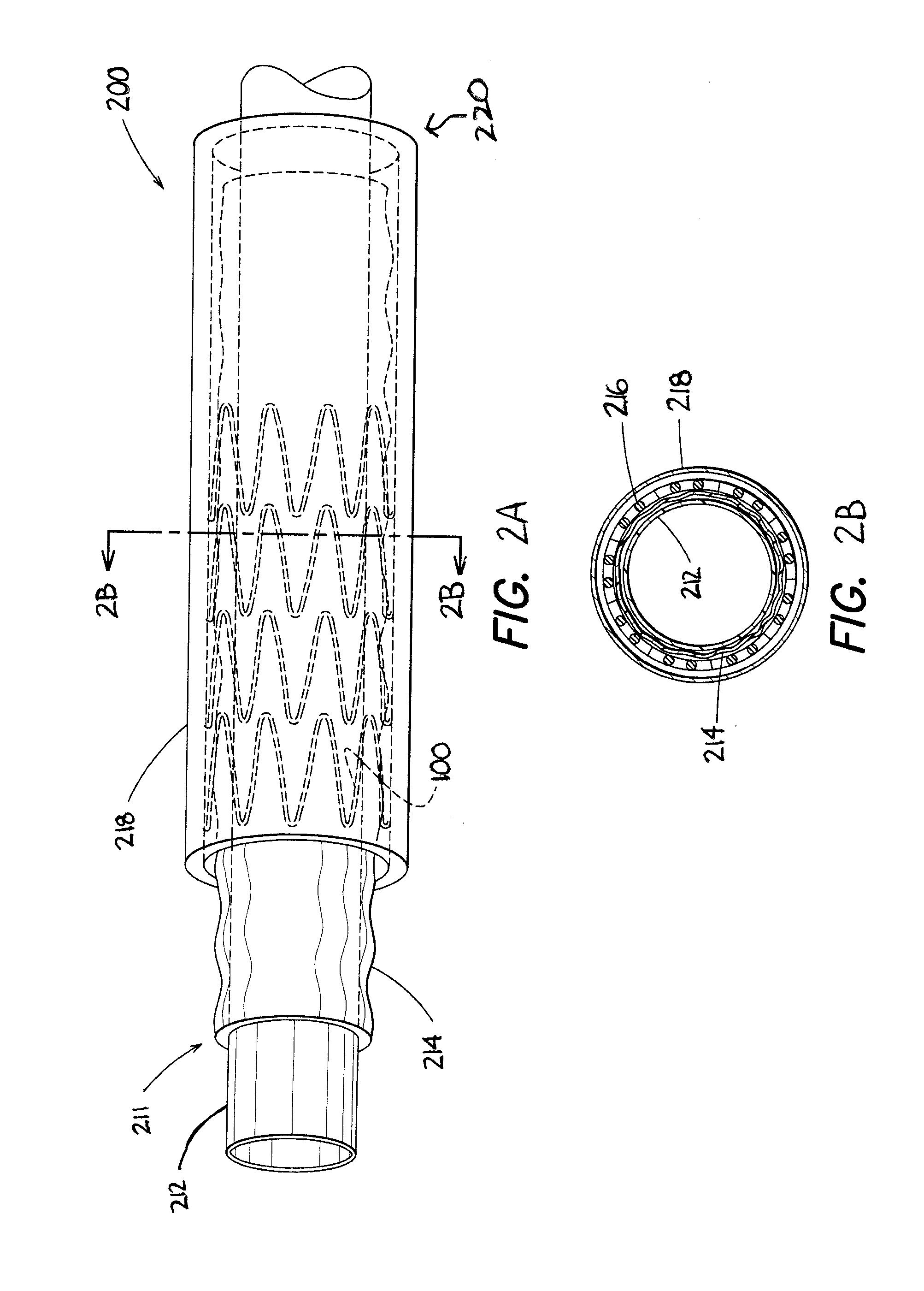 Sheath With Radio-Opaque Markers For Identifying Split Propagation