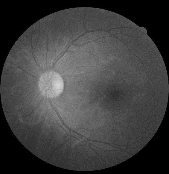 Retinal vessel arteriovenous distinguishing method, device and equipment