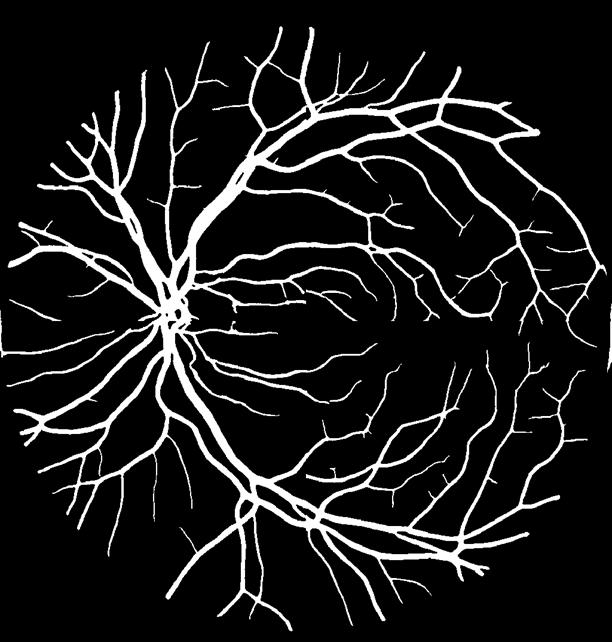 Retinal vessel arteriovenous distinguishing method, device and equipment