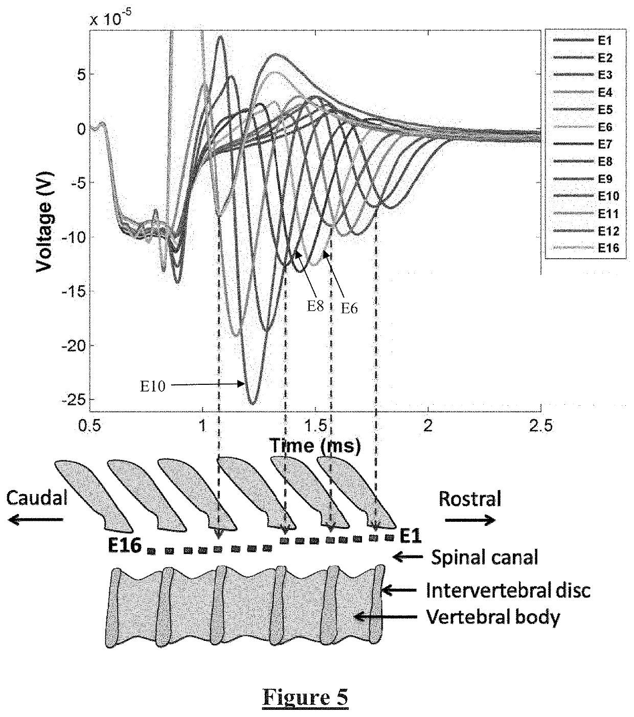 Method and Apparatus for Measurement of Neural Response