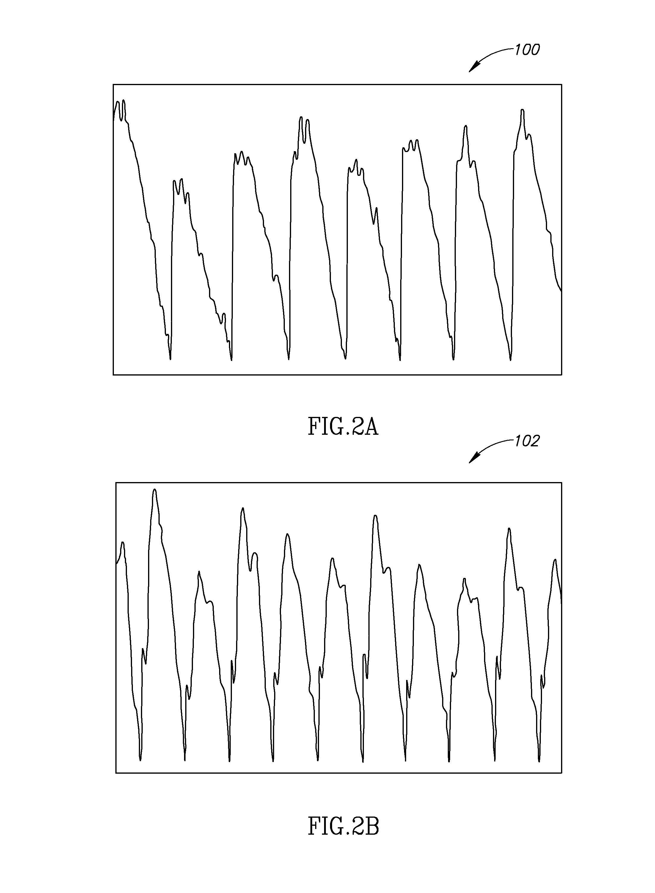 Non-invasive intracranial monitor