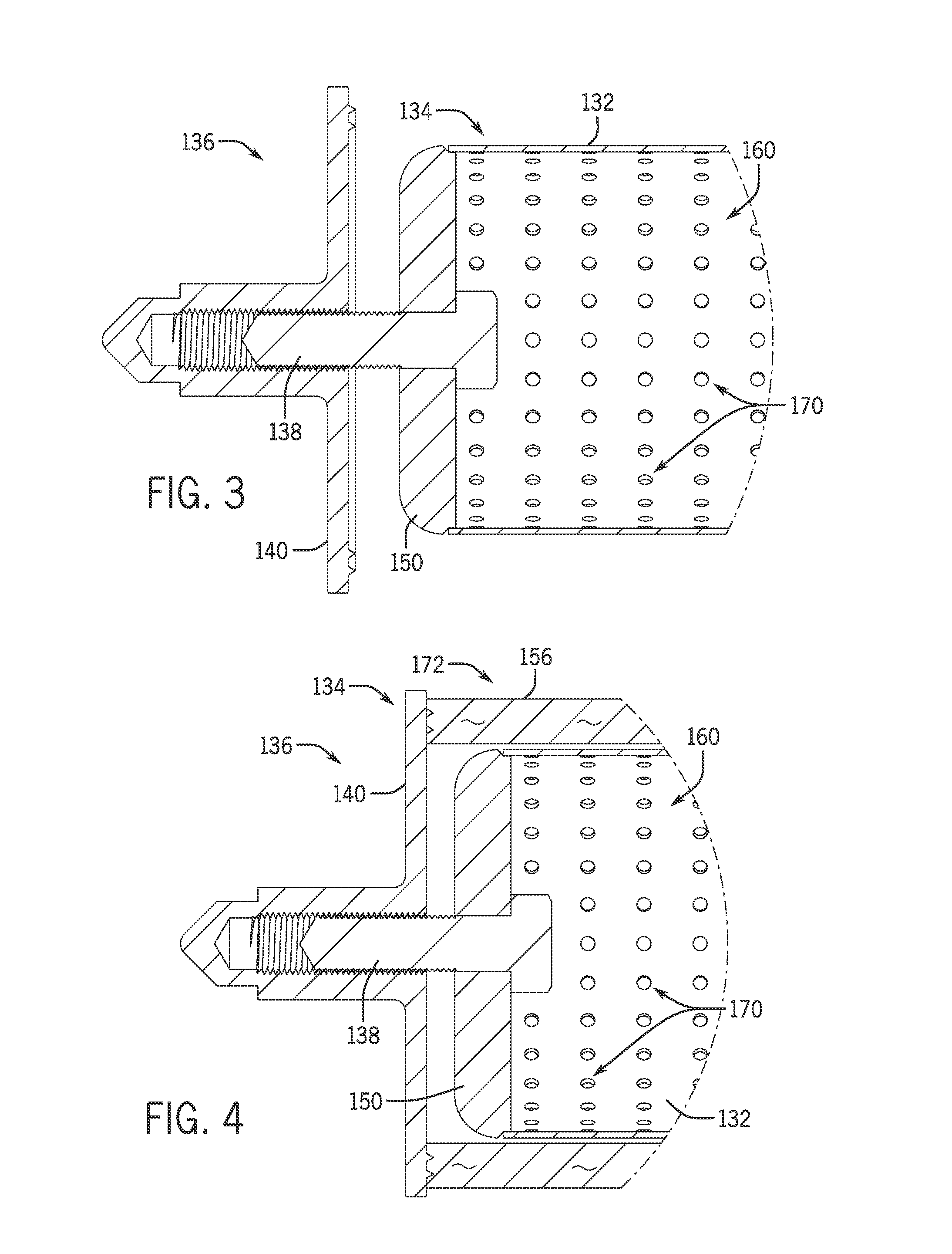 Filter media support core