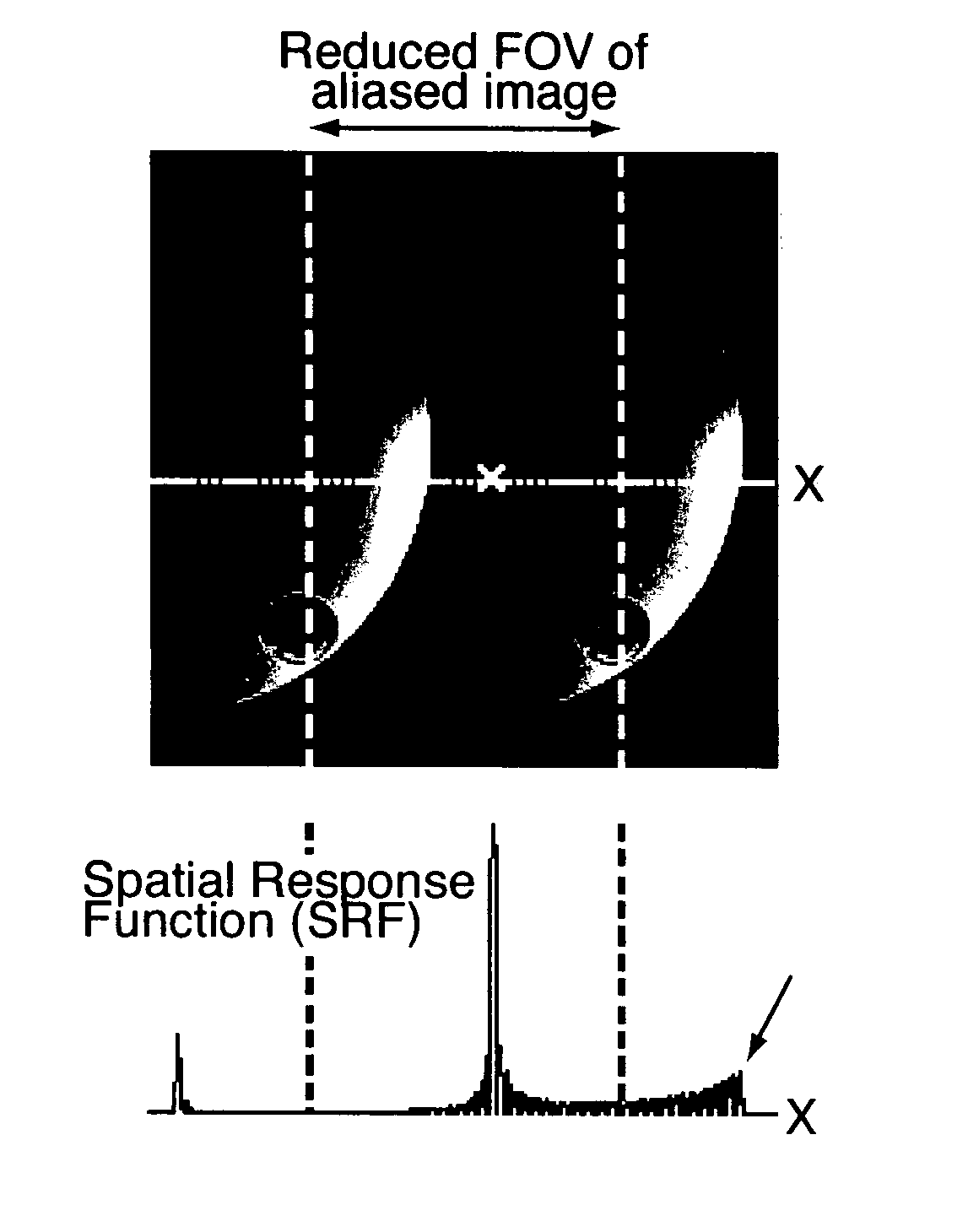 Magnetic resonance imaging method