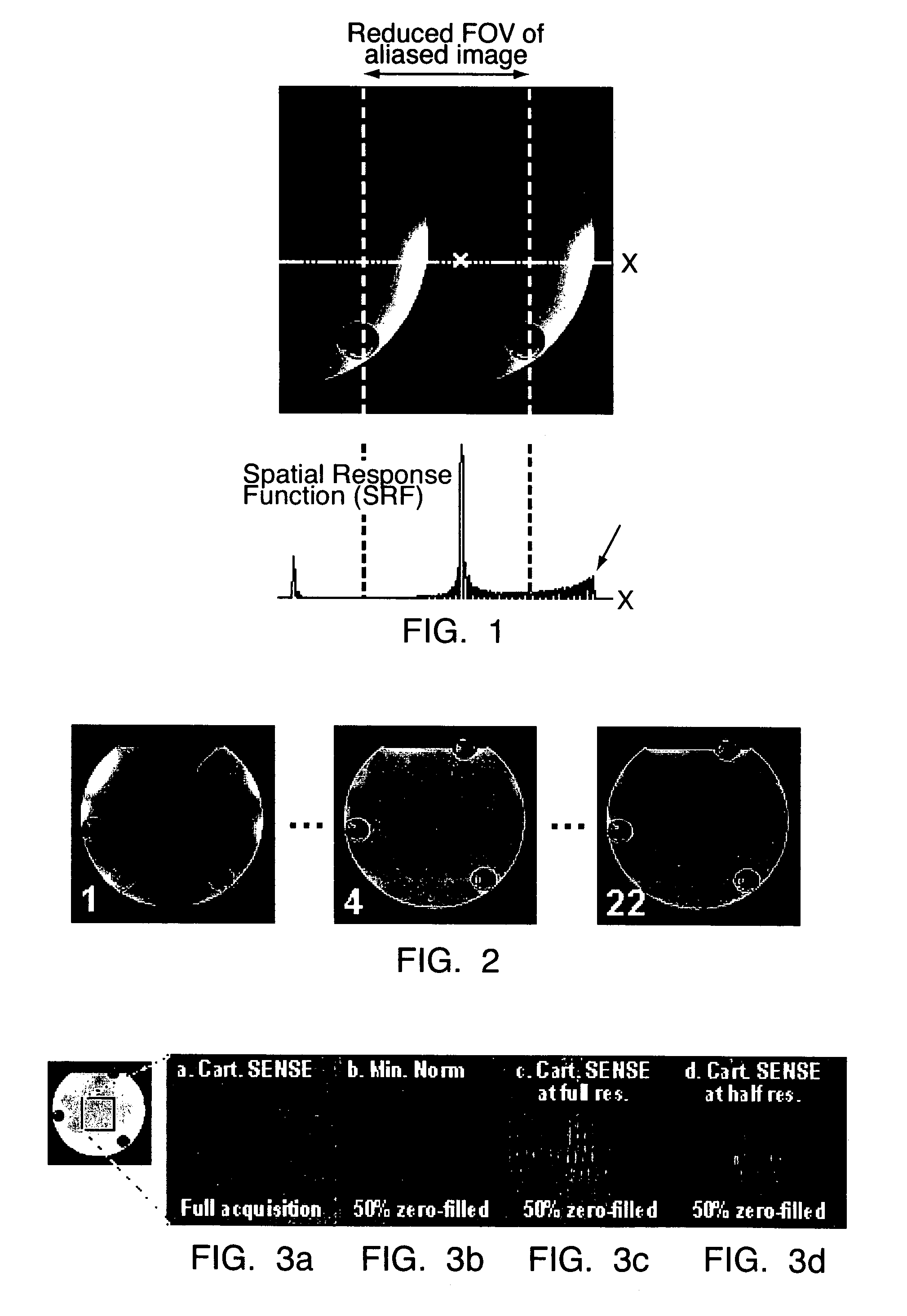 Magnetic resonance imaging method