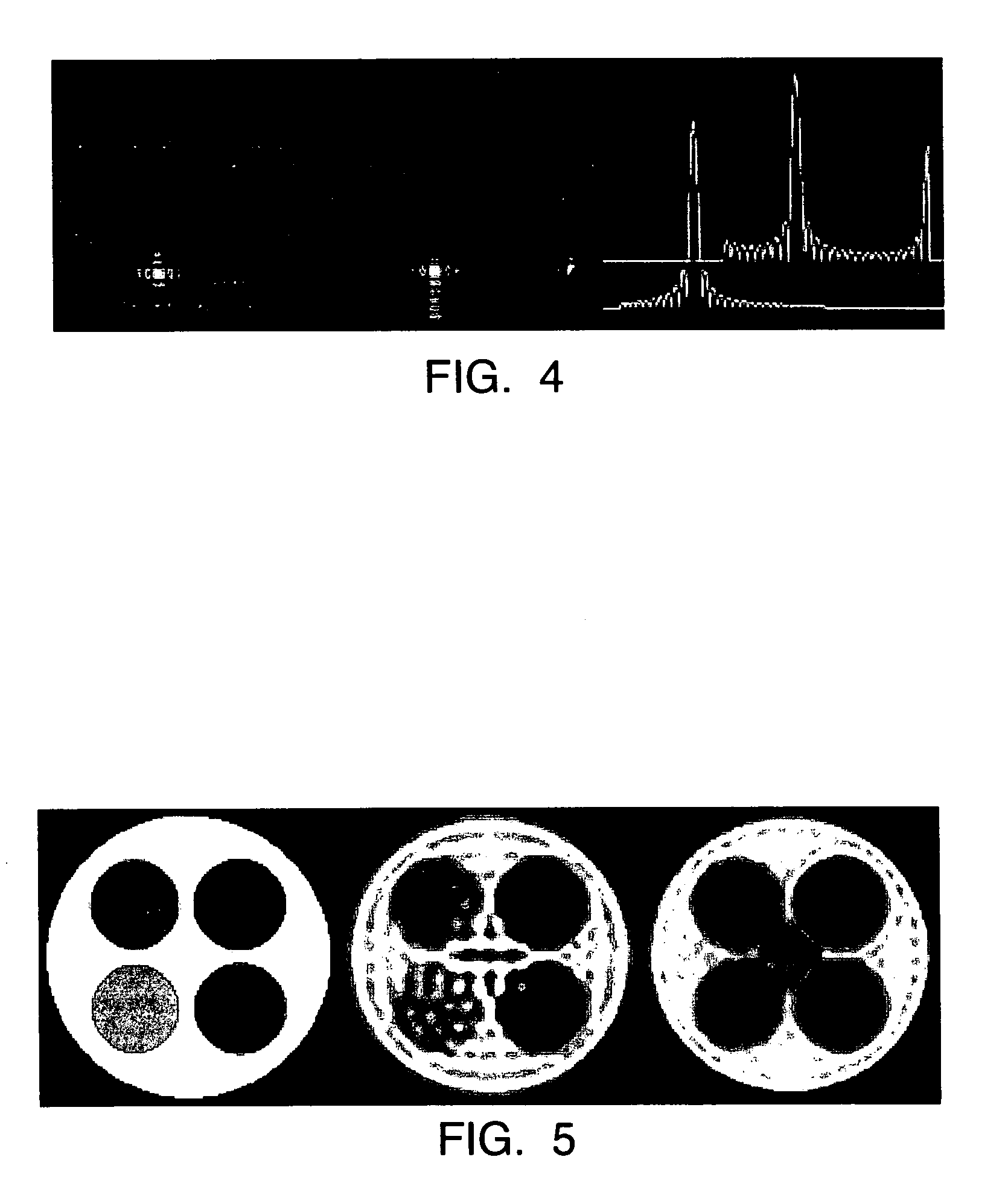 Magnetic resonance imaging method