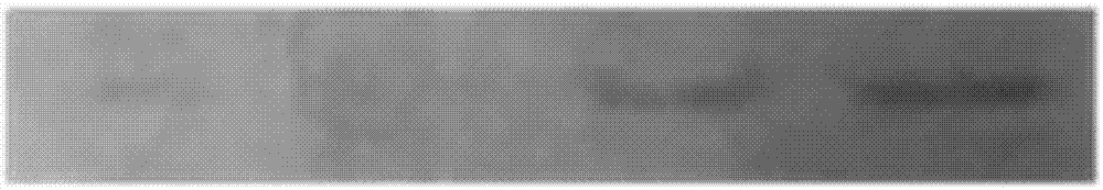 Preparation method of lymphoma-targeted blood platelet targeting drug loading system carrying and loading anti-tumor drug and connecting CD22 monoclonal antibody