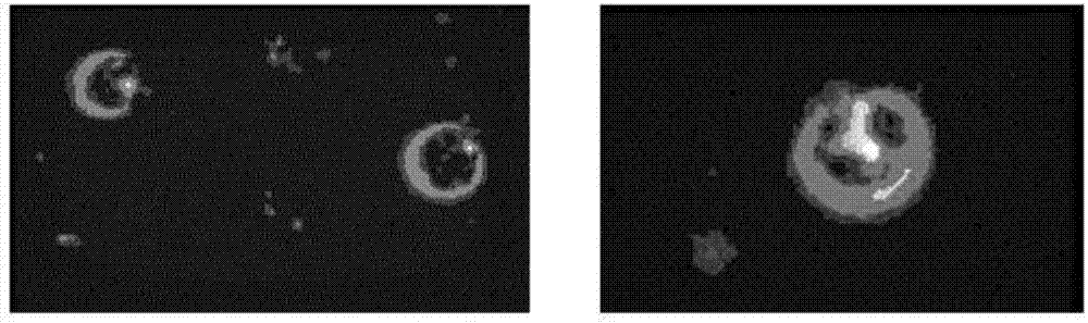 Preparation method of lymphoma-targeted blood platelet targeting drug loading system carrying and loading anti-tumor drug and connecting CD22 monoclonal antibody