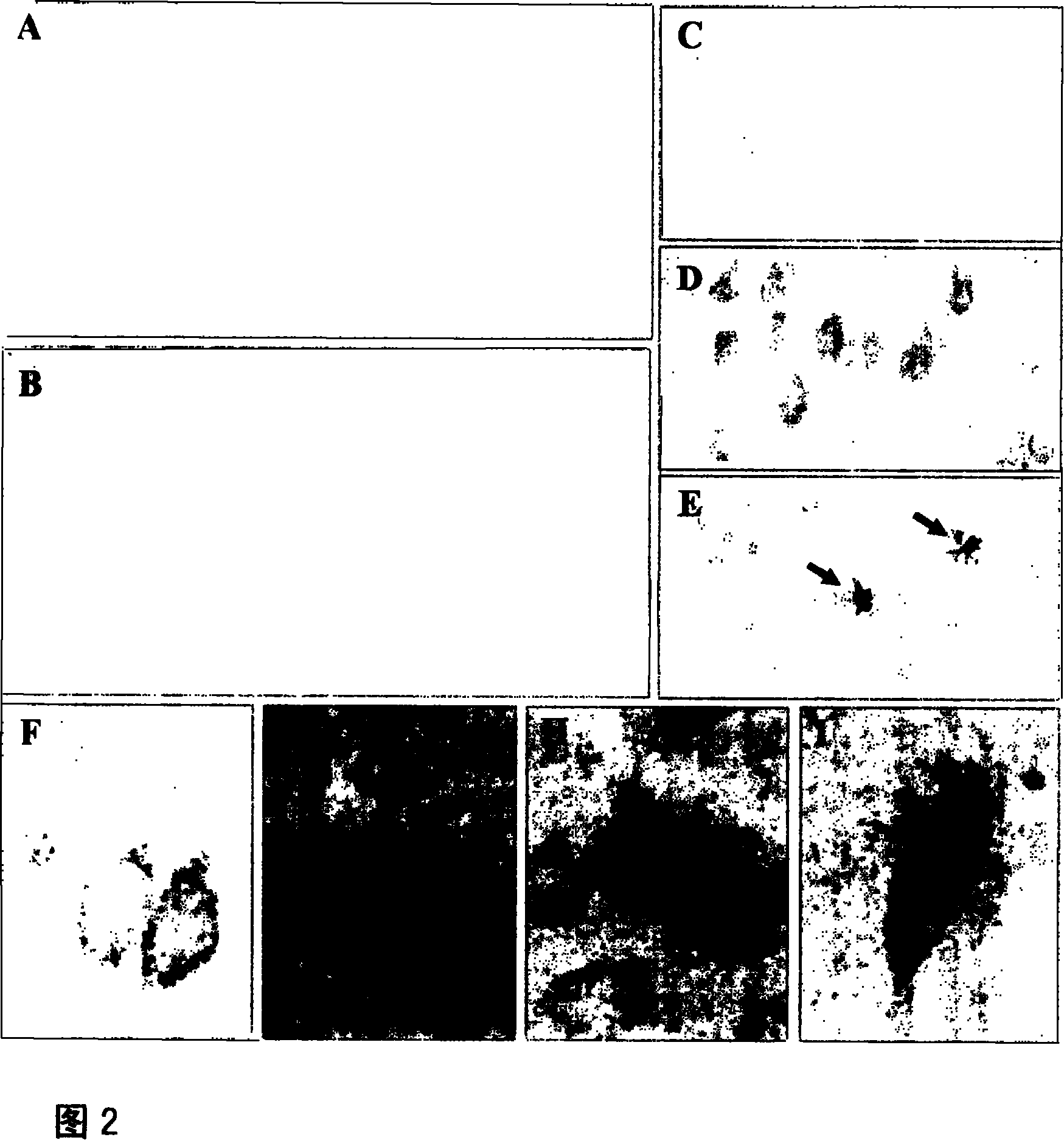 Method for constructing composite type presenile dementia animal model