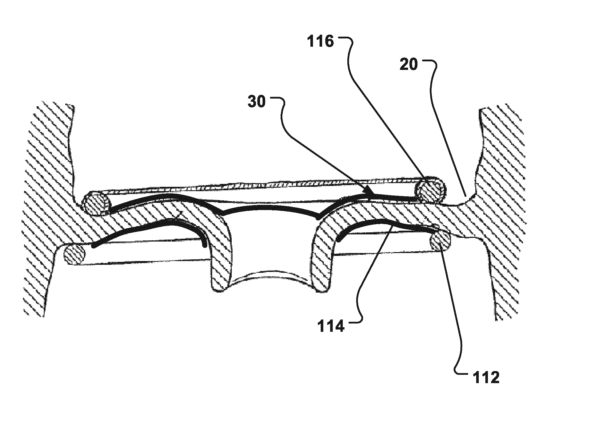 Device And A Method For Improving The Function Of A Heart Valve