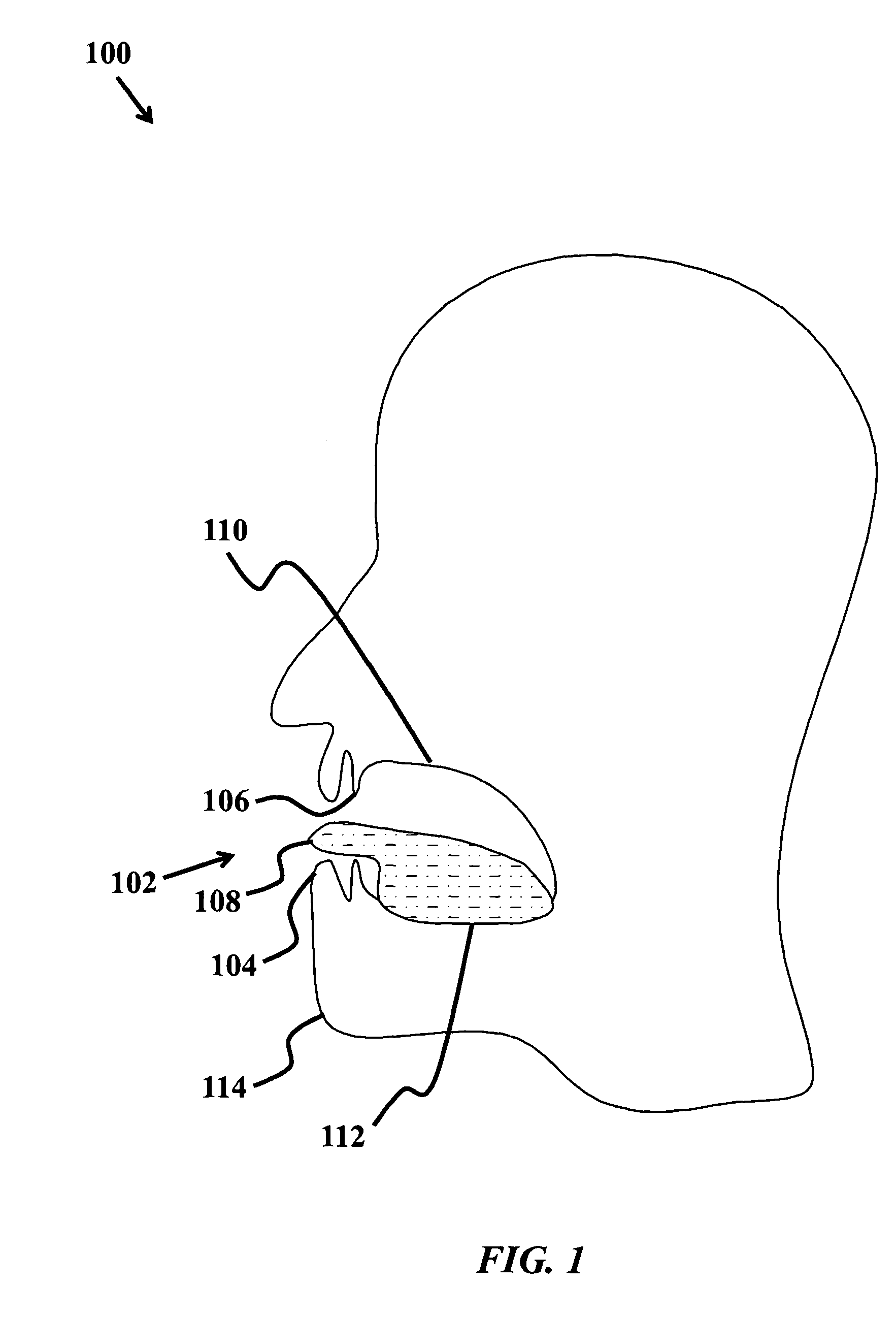 Device and method to treat tissue with electric current