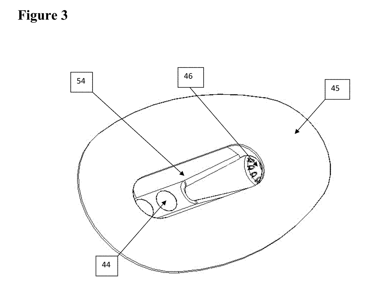 Hydro-block air vent combination catheter system and method of use