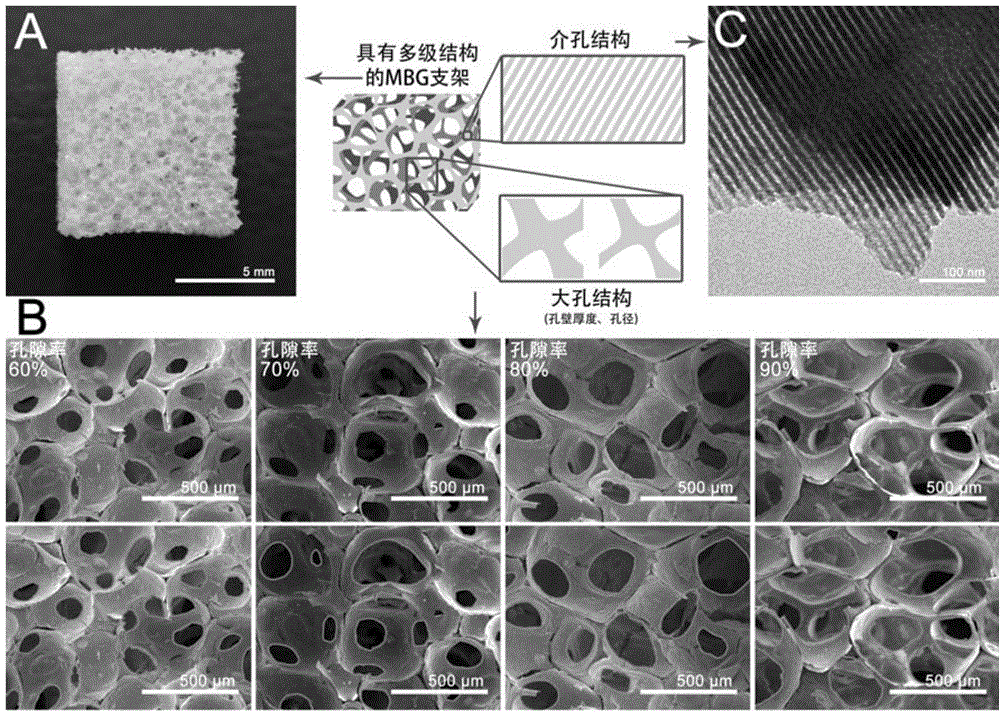 Mesoporous bioactive glass/poly-decyl diacid glyceride composite support as well as preparation method and application thereof