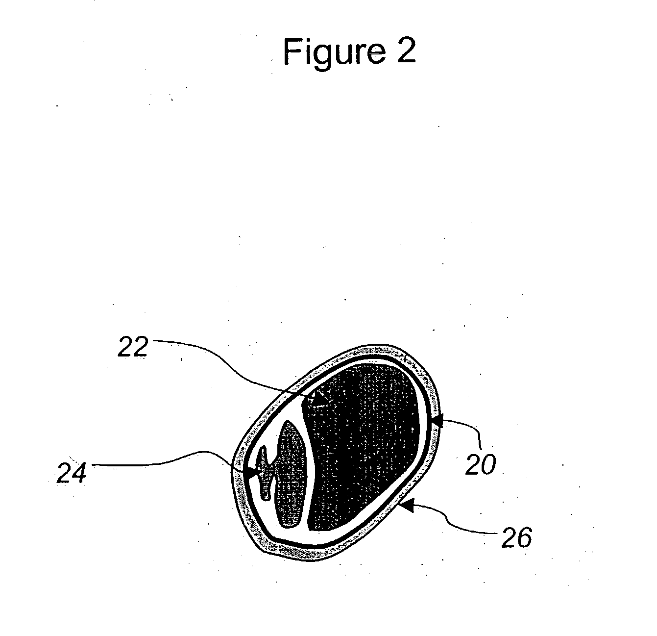 Agricultural seed having protective coatings