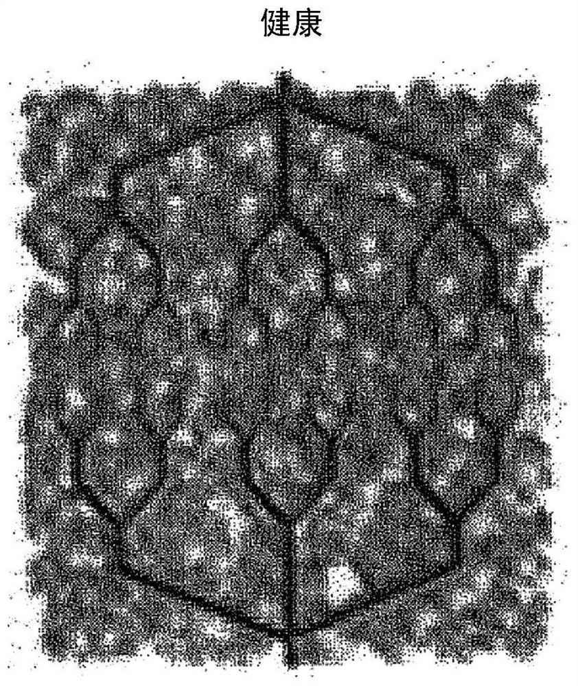 System and method for detecting abnormal tissue using vascular features