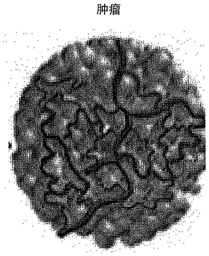 System and method for detecting abnormal tissue using vascular features