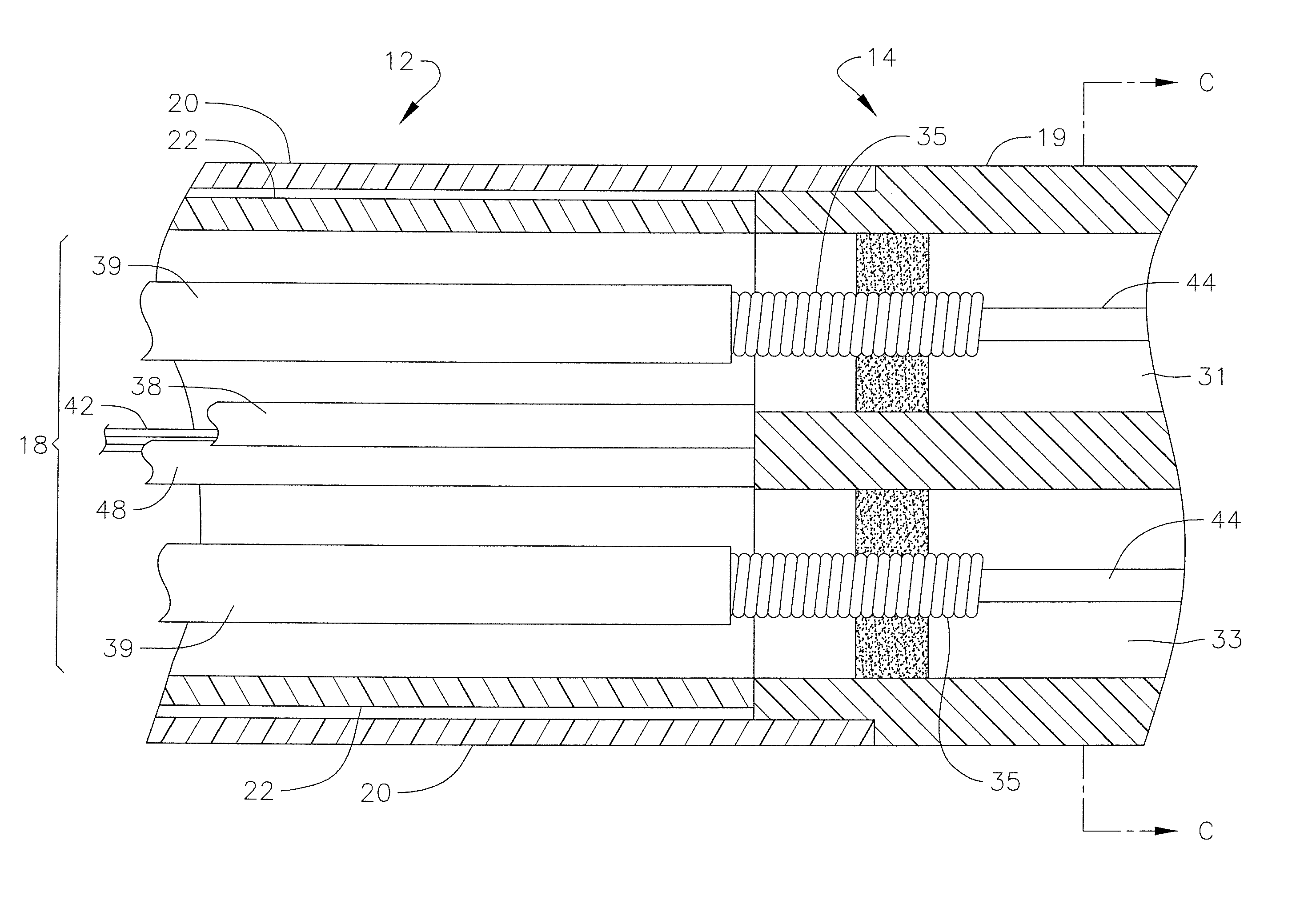 Catheter with thin film pressure sensing distal tip