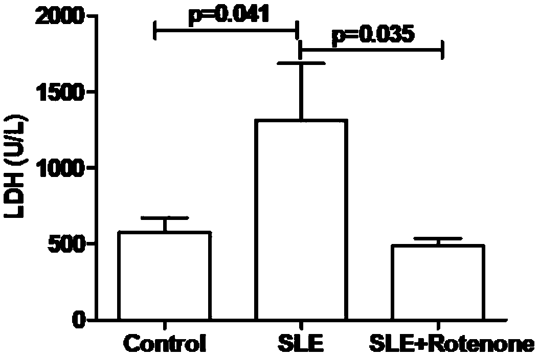 Application of rotenone in preparation of medicine for treating systemic lupus erythematosus