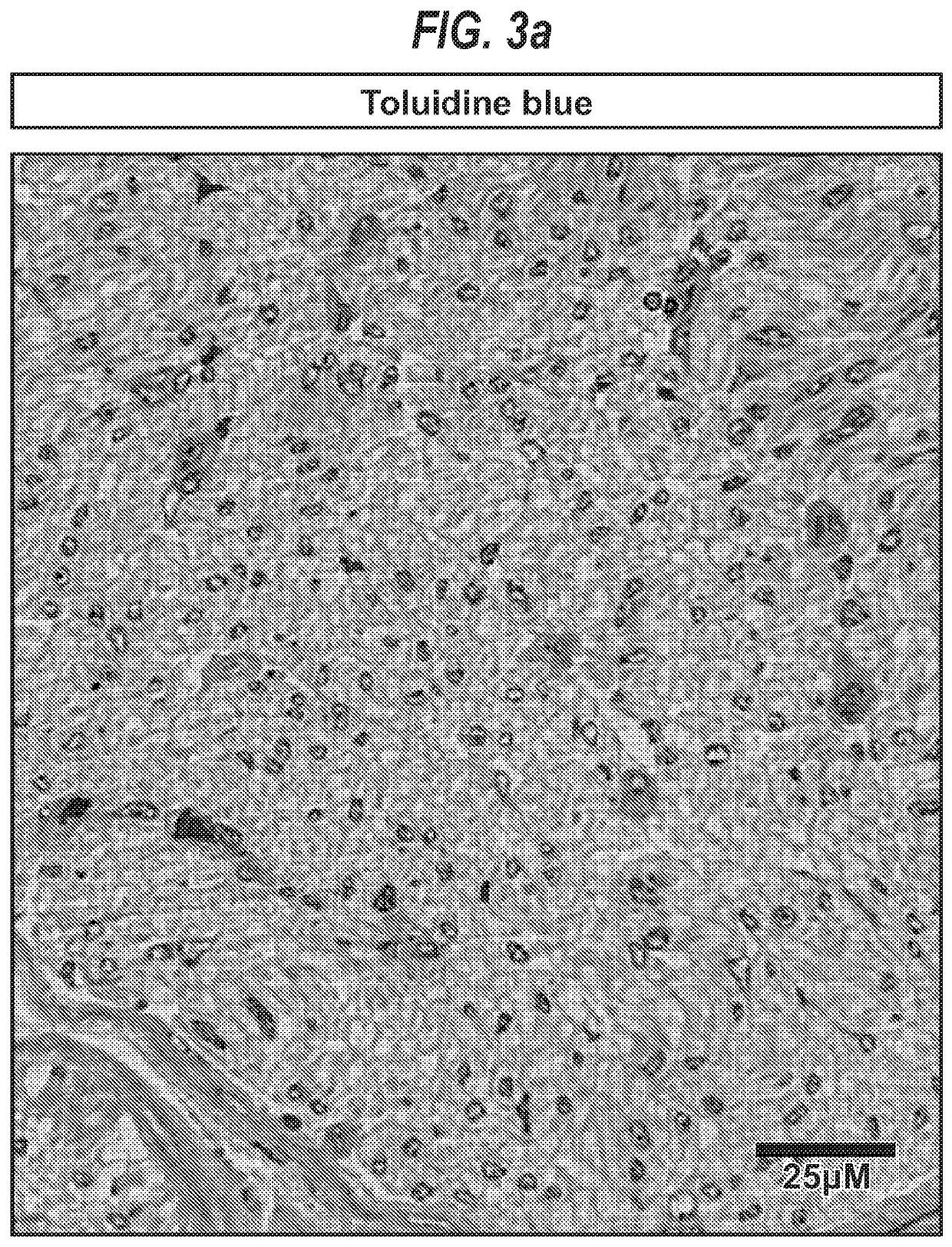 Stimulation of a nerve supplying the spleen