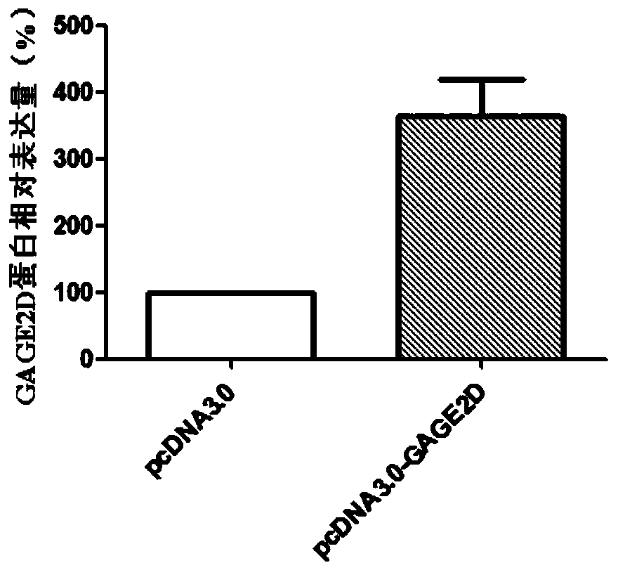 Gene markers for diagnosis and treatment of tongue squamous cell carcinoma