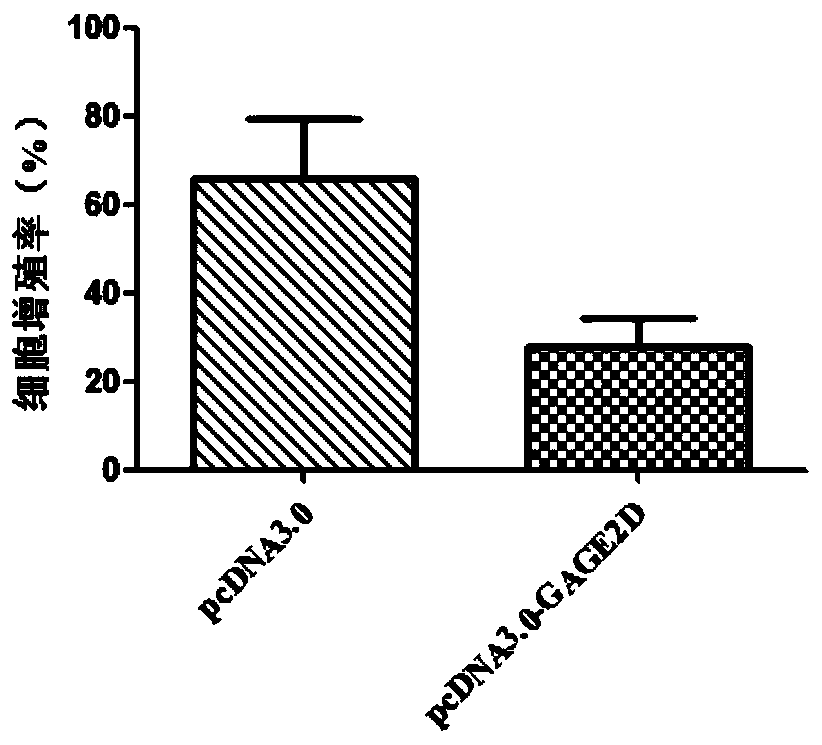 Gene markers for diagnosis and treatment of tongue squamous cell carcinoma