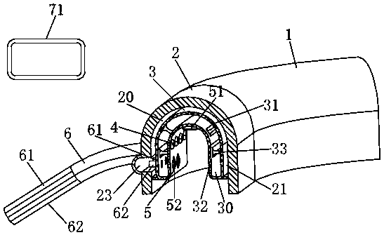 Tooth monitoring device