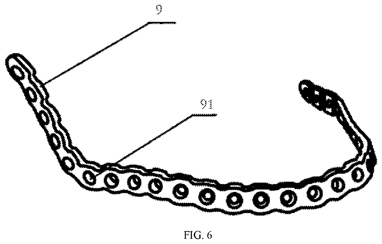 Osteotomy guide plate and preparation method thereof