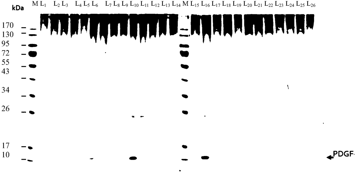 Platelet-derived growth factor modifying gene suitable for silkworm expression and expression vector and application thereof