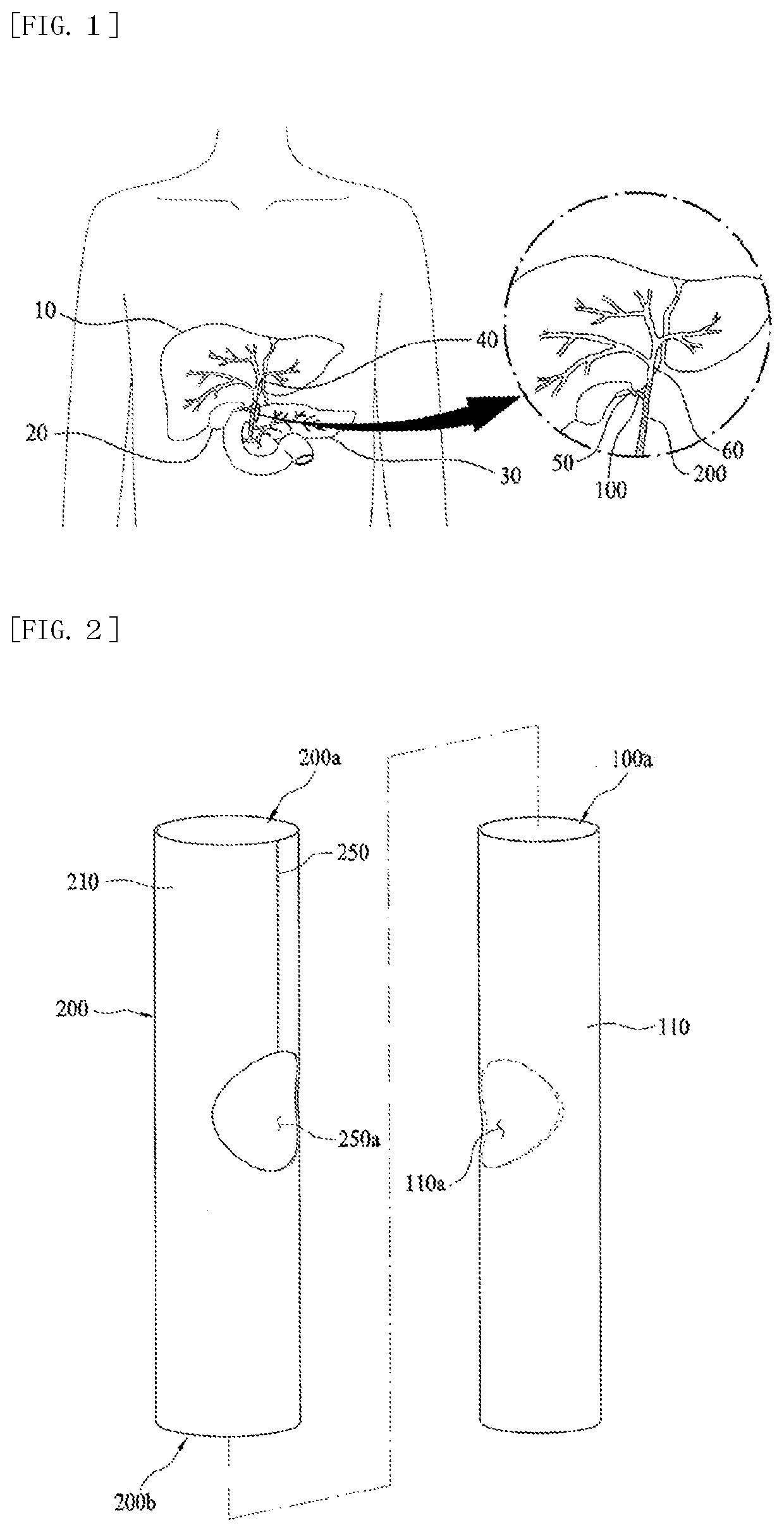 Drainage catheter