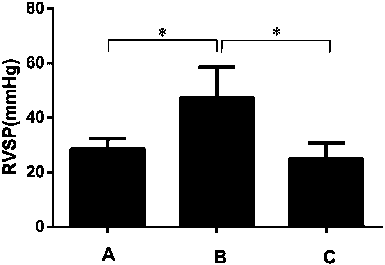 Application of ibrutinib in preparation of drugs for treating chronic hypoxic pulmonary hypertension