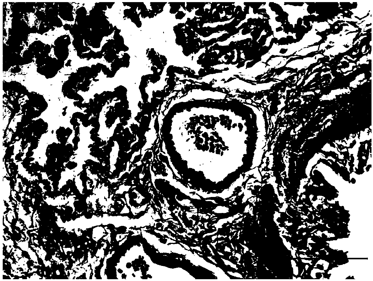 Application of ibrutinib in preparation of drugs for treating chronic hypoxic pulmonary hypertension