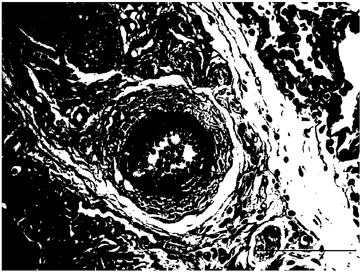 Application of ibrutinib in preparation of drugs for treating chronic hypoxic pulmonary hypertension