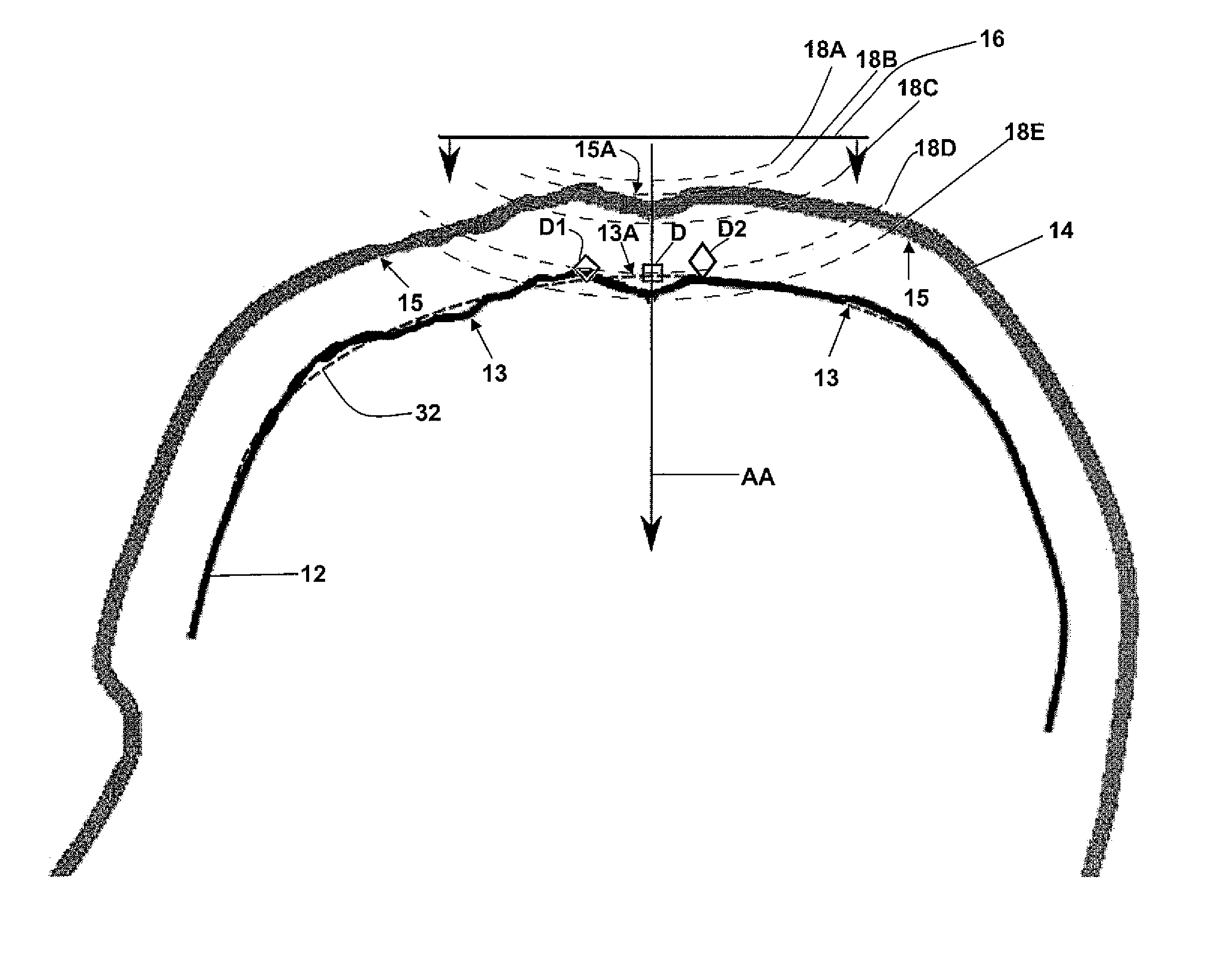 Method and System for Displaying the Electric Field Generated on the Brain by Transcranial Magnetic Stimulation