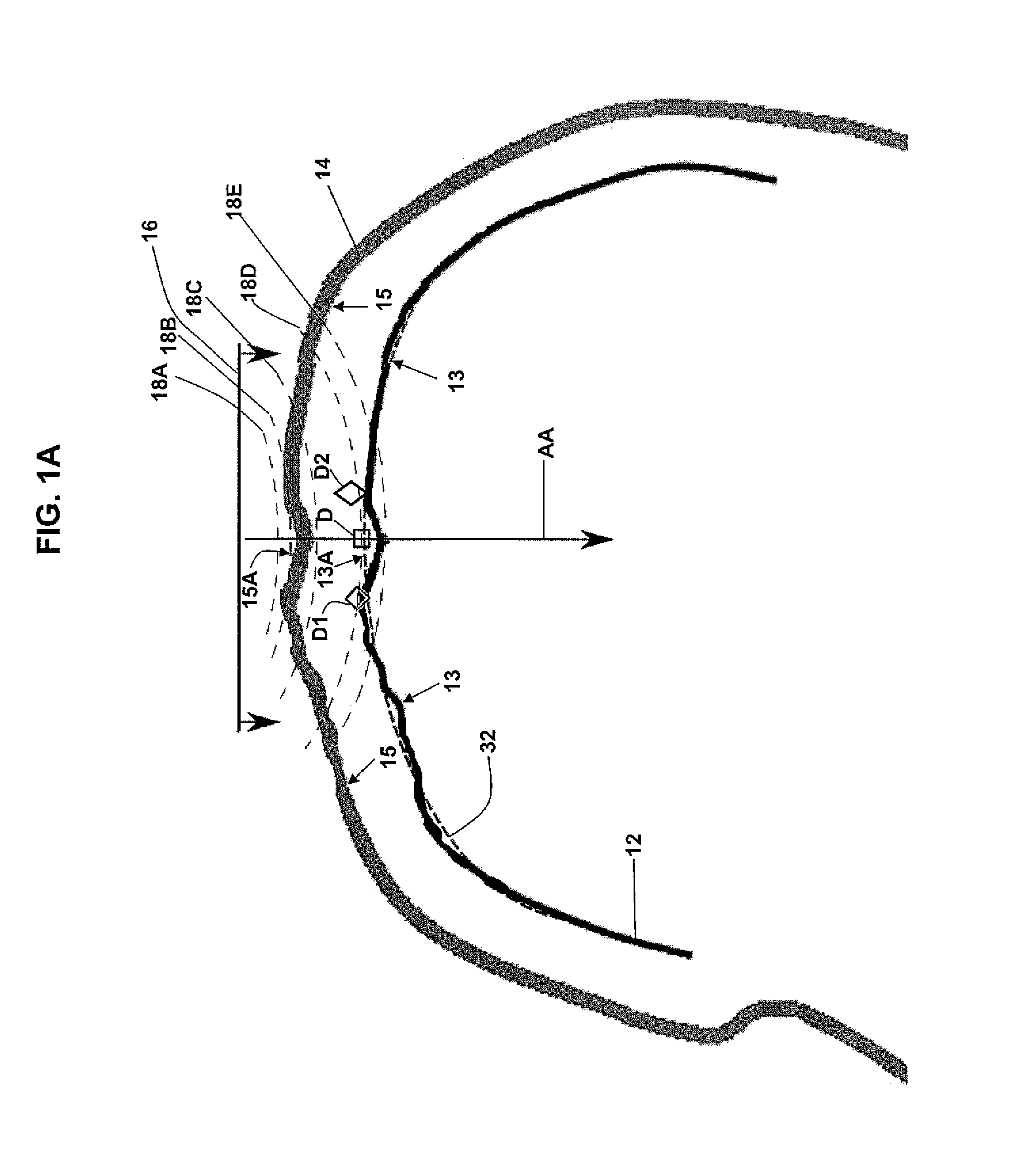 Method and System for Displaying the Electric Field Generated on the Brain by Transcranial Magnetic Stimulation