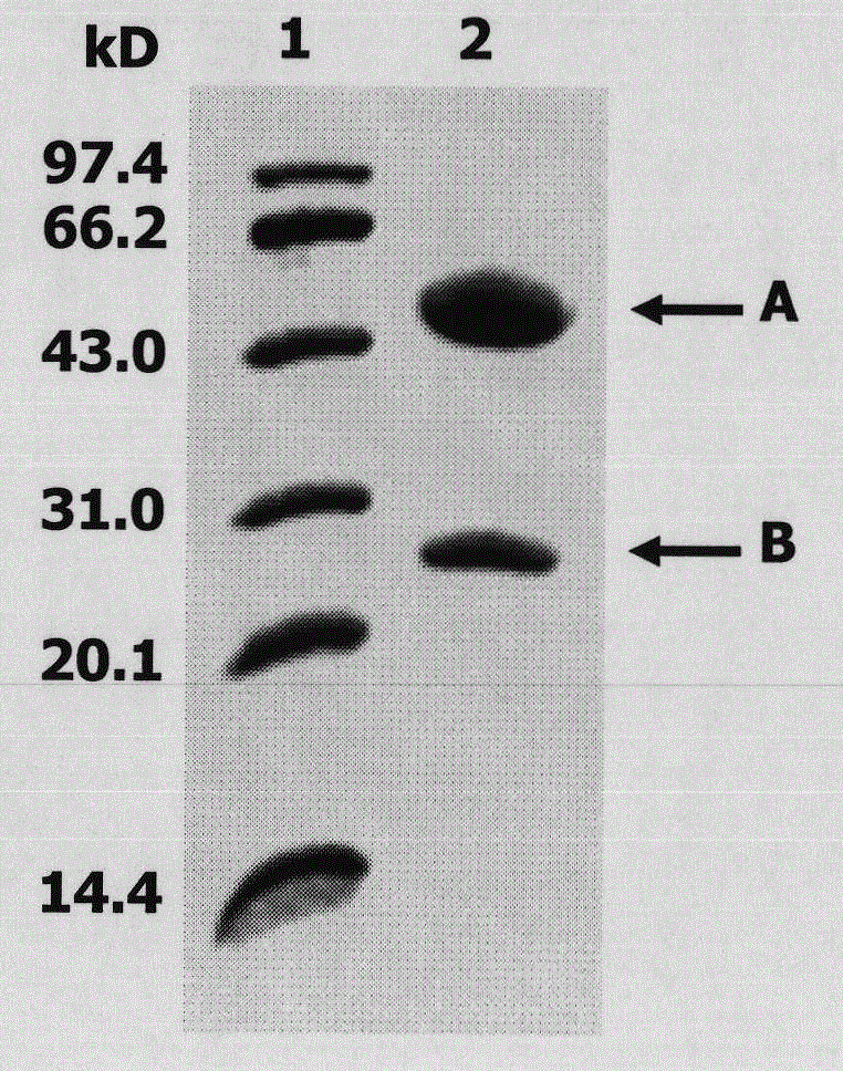 Preparation and application of anti-Staphylococcus aureus eLtaS protein monoclonal neutralizing antibody E4-2