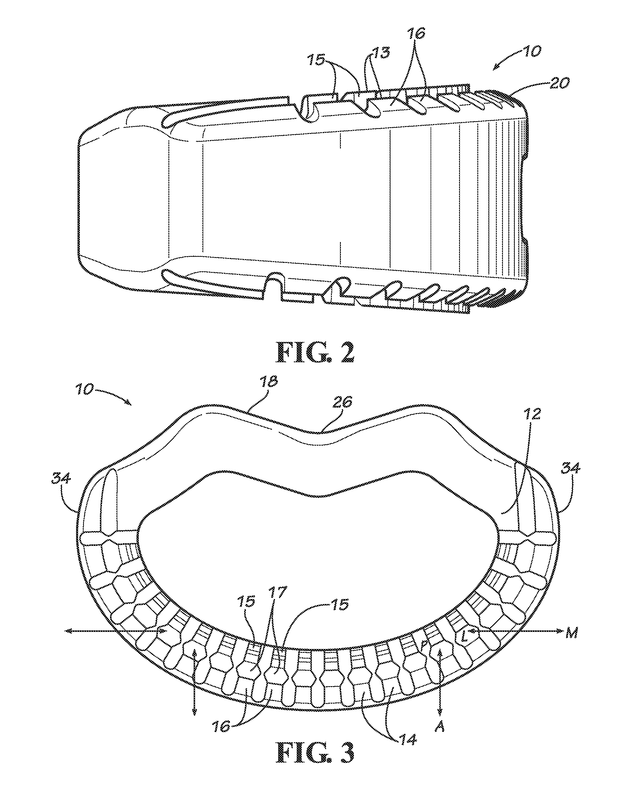 Spinal implants