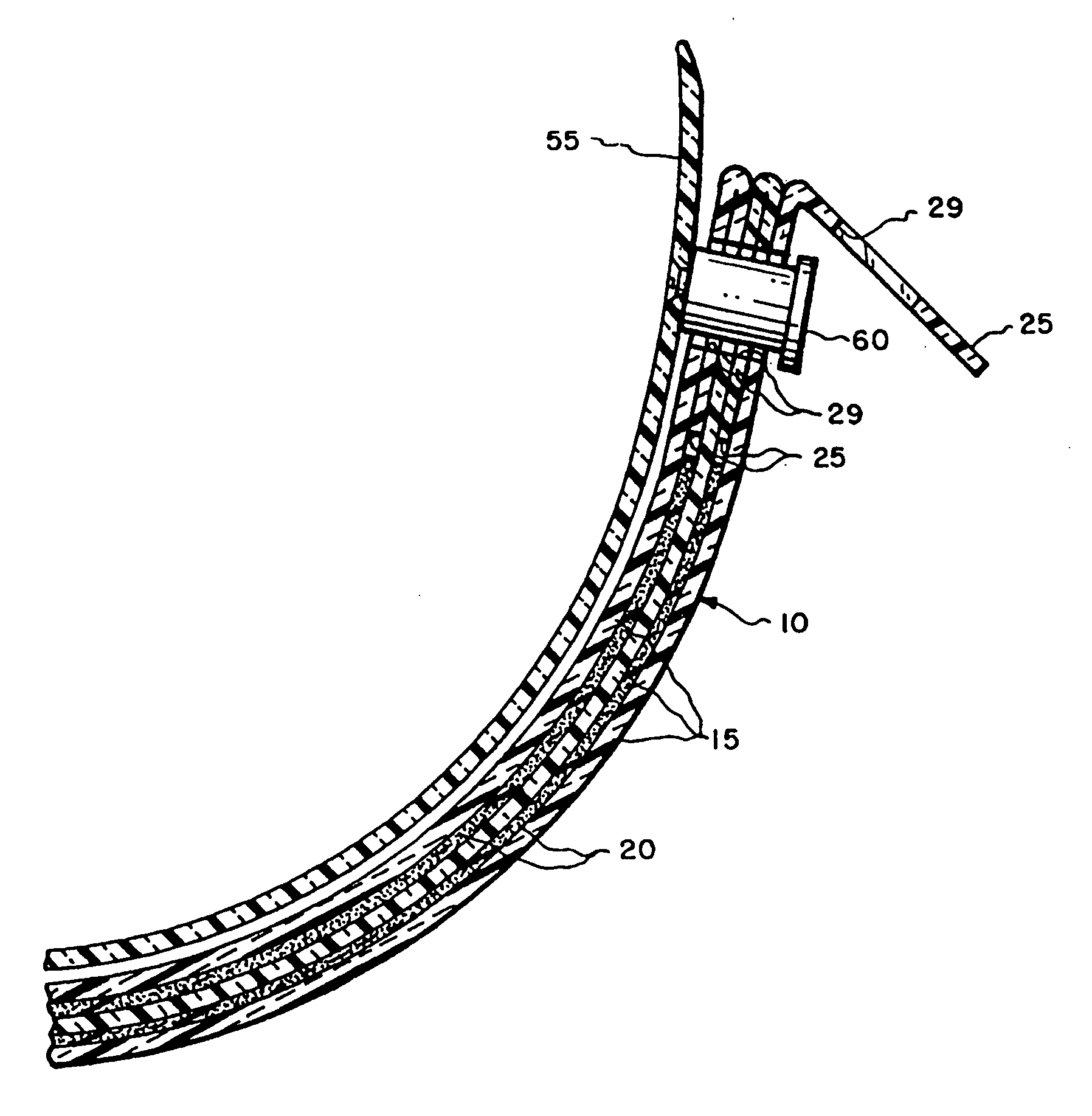 Optical stack of laminated removable lenses