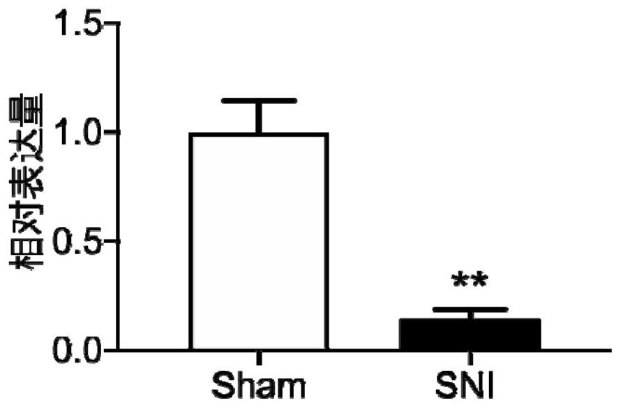 Application of ENSRNOT00000084277 in preparation of medicine for preventing and treating chronic pain related depressive emotion