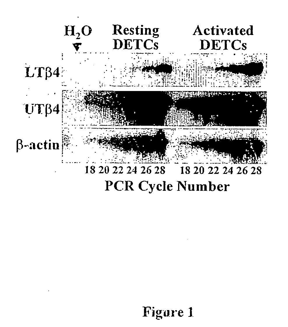 Anti-inflammatory and wound healing effects of lymphoid thymosin beta-4