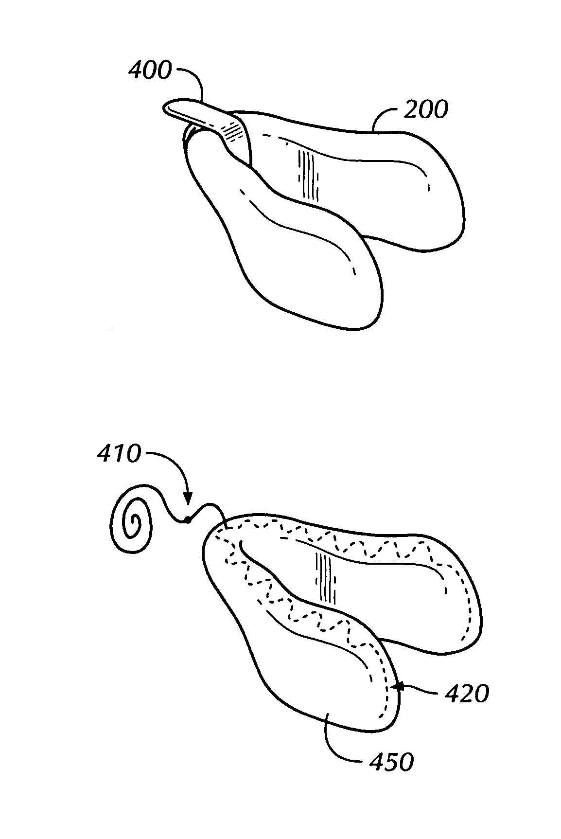 Lingual Vestibular Dosage-form and Delivery System for Transmucosal Administration of Pharmaceutical Agents