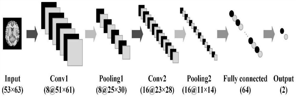 A method for constructing an ICA-CNN classification framework for resting-state complex fMRI data from patients and healthy subjects