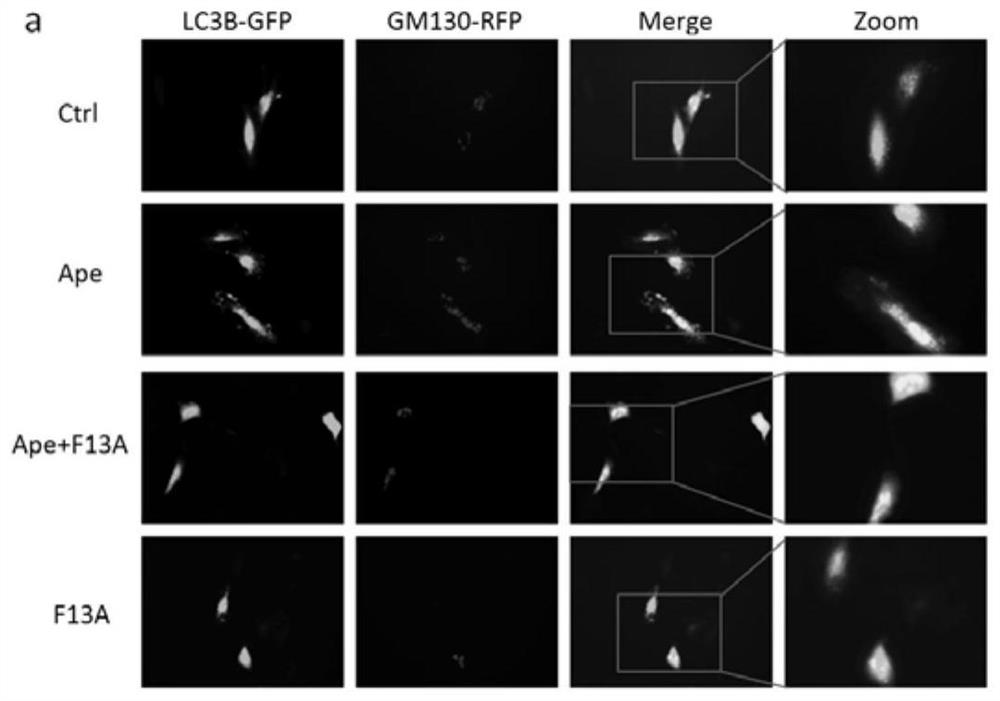 Application of siRNA-golph3 in the preparation of drugs for preventing or treating cardiomyocyte hypertrophy